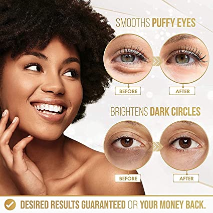 Puffy Eyes and Dark Circles Treatments